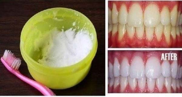 How-to-DIY-Natural-Teeth-Whitening-in-Minutes-at-Home