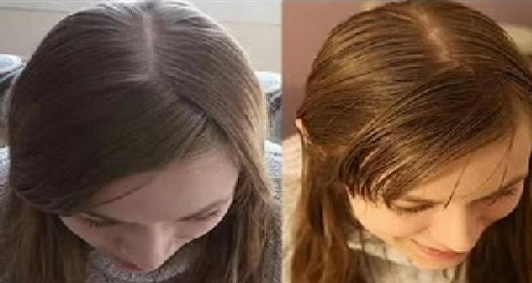 She-Didn’t-Wash-Her-Hair-For-31-Days-This-Is-What-Happened-To-Her-After-The-Experiment