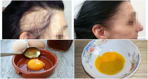 The-Magic-Recipe-For-Fastest-Hair-Growth-3-Ingredients-Only