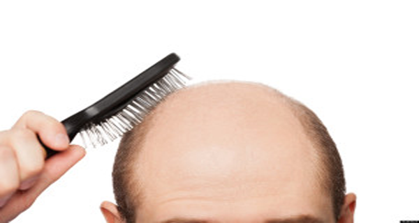 Recipe-for-baldness-Hair-begins-to-grow-after-two-days-RECIPE