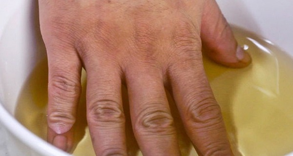 She-Put-Her-Hands-in-Vinegar-Twice-a-Week.-The-Results-–-UNBELIEVABLE