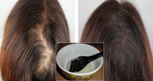 Extremely-Effective-1-Ingredient-Hair-Mask-That-Will-Save-and-Regrow-Your-Hair