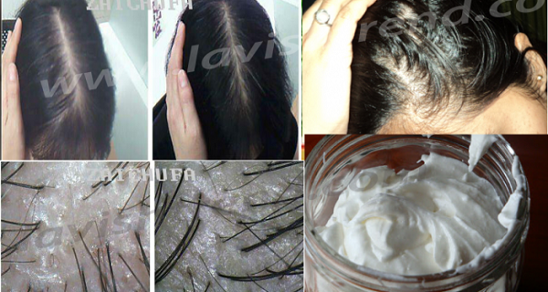 She-Had-Very-Thin-Hair-But-She-Use-This-Ingredient-And-Gets-Thick-And-Heavy-Hair-Within-a-Week