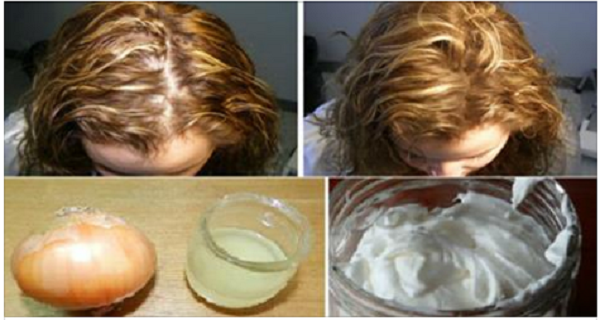 She-Had-Very-Thin-Hair-But-She-Used-This-Ingredient-And-Got-Thick-Hair-Within-A-Week