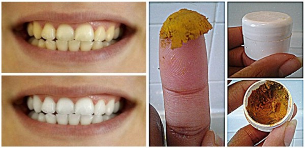 homemade-tooth-paste
