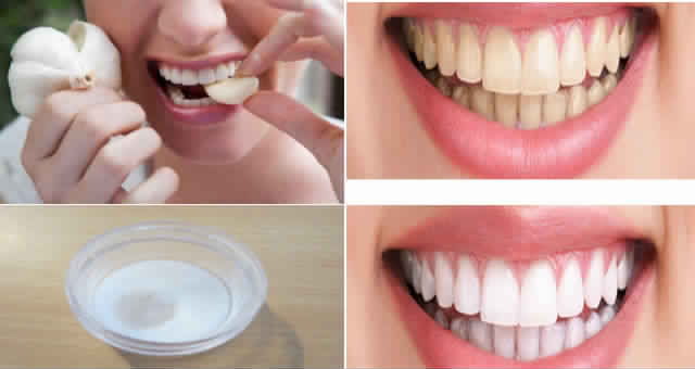 Whiten-Teeth