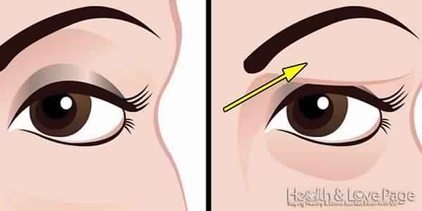 How-to-Treat-Droopy-Eyelids-Naturally.-The-Results-Are-Amazing