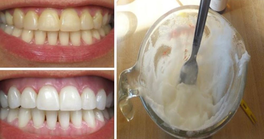 how-to-whiten-teeth-naturally-at-home-with-2-ingredients