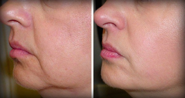 no-more-wrinkles-and-sagging-skin-on-your-face-2-ingredients-only