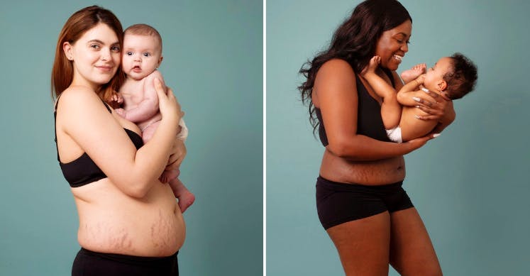 Cette campagne célèbre les corps post-partum pour mettre fin aux attentes irréalistes envers les nouvelles mamans